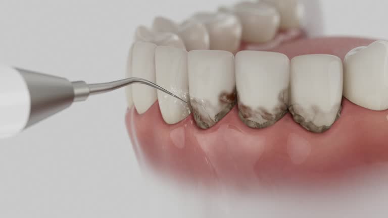Trusted Teeth Whitening service in Romeo, MI - Dentist Open Now